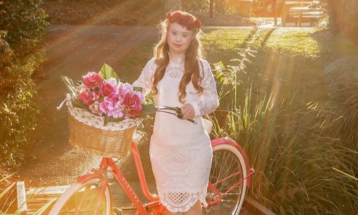 Девушка для исполнения своей мечты занималась плаванием, ходьбой, была в команде чарлидеров