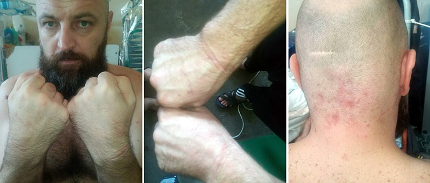 Николай Цукур: «Внезапно человек в медицинской маске приказал всем остановиться. Думаю, испугался: у меня пошли гной и кровь из старой раны, которую не успел залечить до ареста»