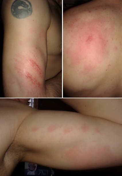 Максим Глебов: «Били в затылок кулаком, по мышцам трапеции, по ногам. Я сам оделся, когда по ступенькам поднимали, заехали мне в челюсть»