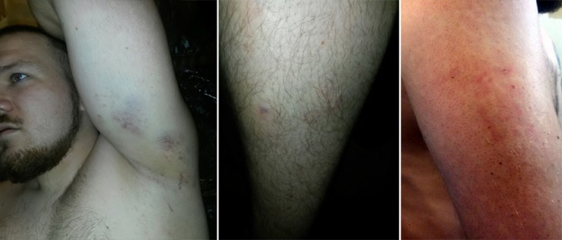 Борис Гульчук: «Навалились шестеро или семеро, заломили руки, насильно стянули одежду. Периодически наносили удары, я спрашивал: «Зачем?». Они: «Нравится прокуроров обижать? Тогда получай!»