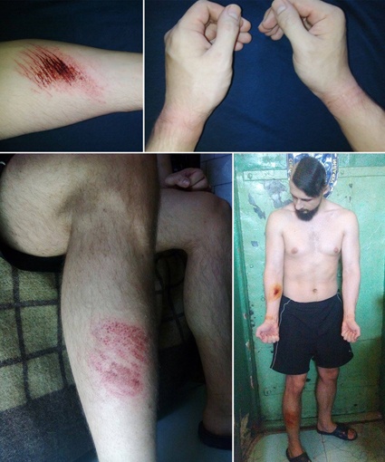 Андрей Демчук: «Зачем били? Думаю, прокуратура хочет запугать. Ну так передайте Луценко и Матиосу — не выйдет»