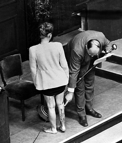 Бывшая пленница нацистского концлагеря демонстрирует на Нюрнбергском процессе следы экспериментов