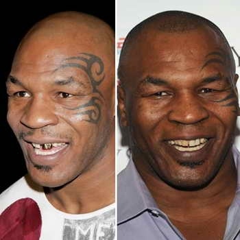 В случае с боксером Майком Тайсоном эстетисты сделали все, что смогли. Фото: vev.ru