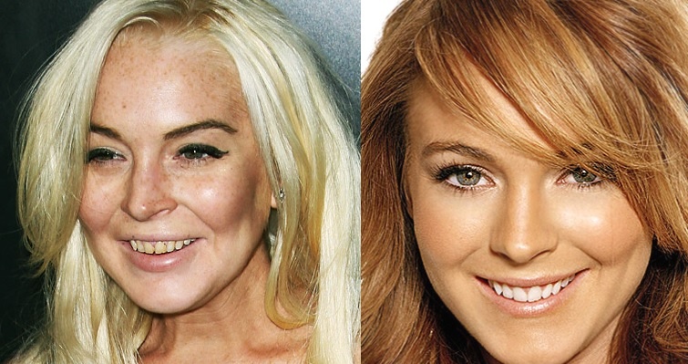 Американская актриса Линдси Лохан. Фото: medikforum.ru